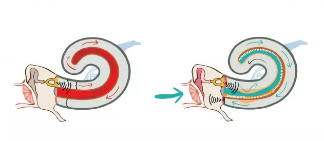 hallórendszer és belső fül működése