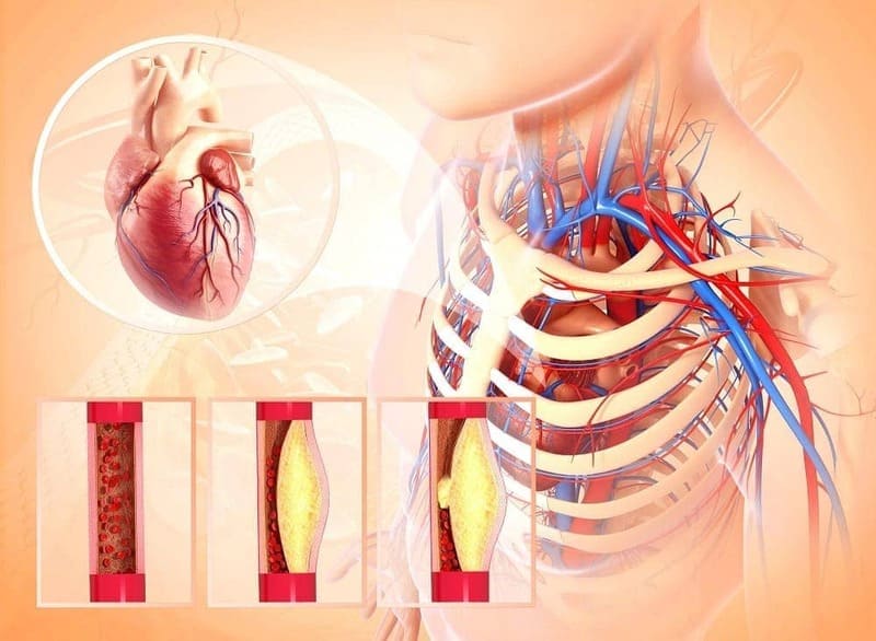 szív- és érrendszeri támogatás természetes módon – Cardiotensive Vélemények