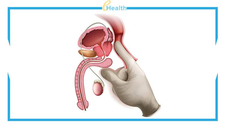 prosztata működése és húgyutak kapcsolata férfi anatómia ábra
